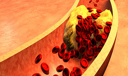What Is Cholesterol? Getting to Grips with Heart Health