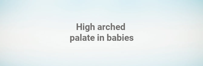 High arched palate in babies