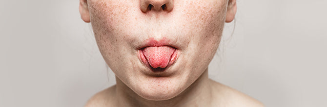 Burning Mouth Syndrome Causes and Treatments