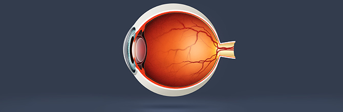 Age-Reltaed Macular Degeneration Explained