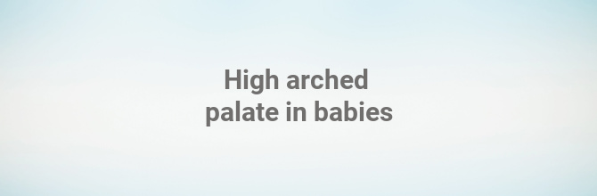 High arched palate in babies 
