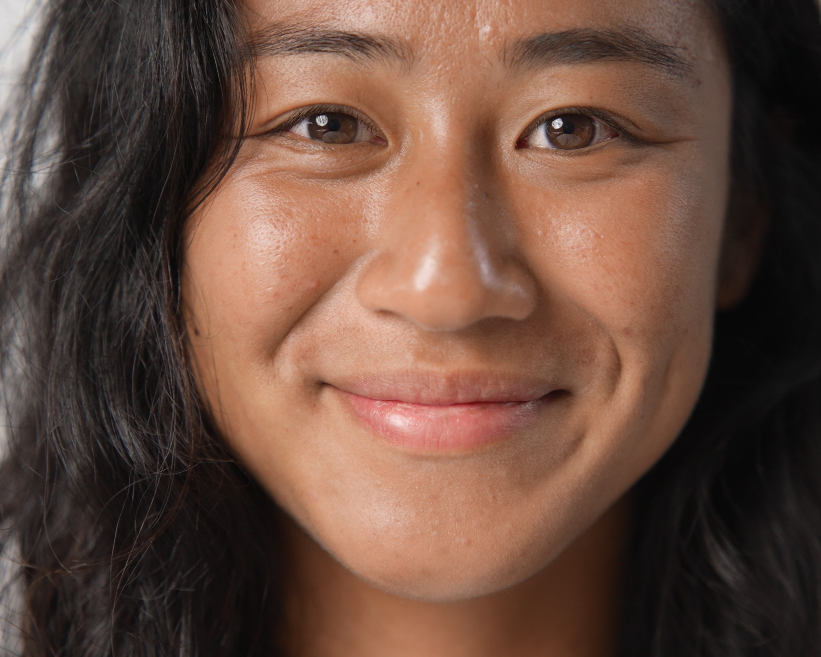 The Unsung Hero of Fertility: Could Myo-Inositol Be the Secret Ingredient for Better Eggs?