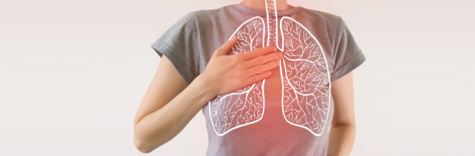 What is bronchiectasis?