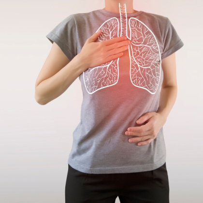 What is bronchiectasis?