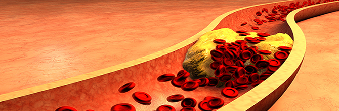 Cholesterol and Heart Health