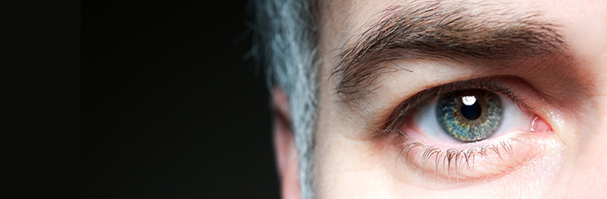 Causes of Cataracts