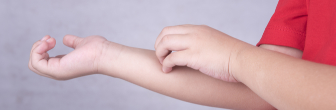 Skin Conditions in Children: How to Soothe Your Child's Skin