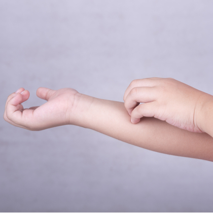 Skin Conditions in Children: How to Soothe Your Child's Skin