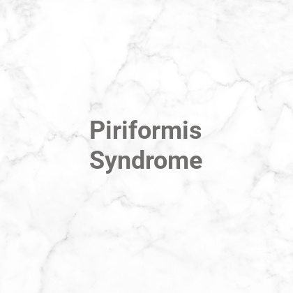 What is piriformis syndrome?