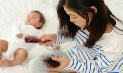 Everything you need to know about postpartum hair loss