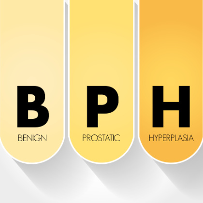 Benign prostatic hyperplasia: Signs and treatments